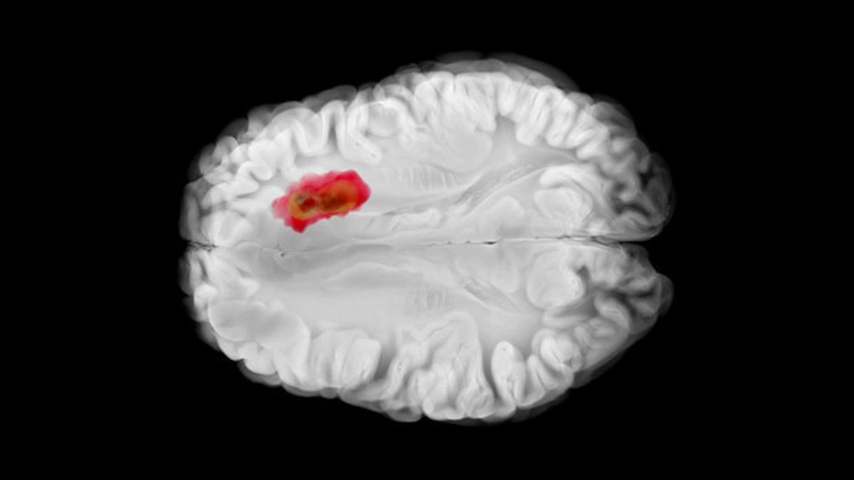 haber 1783342043